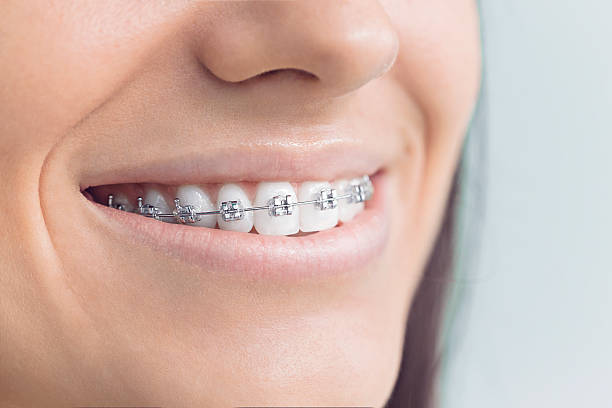Best Root Canal Treatment  in Medina, OH